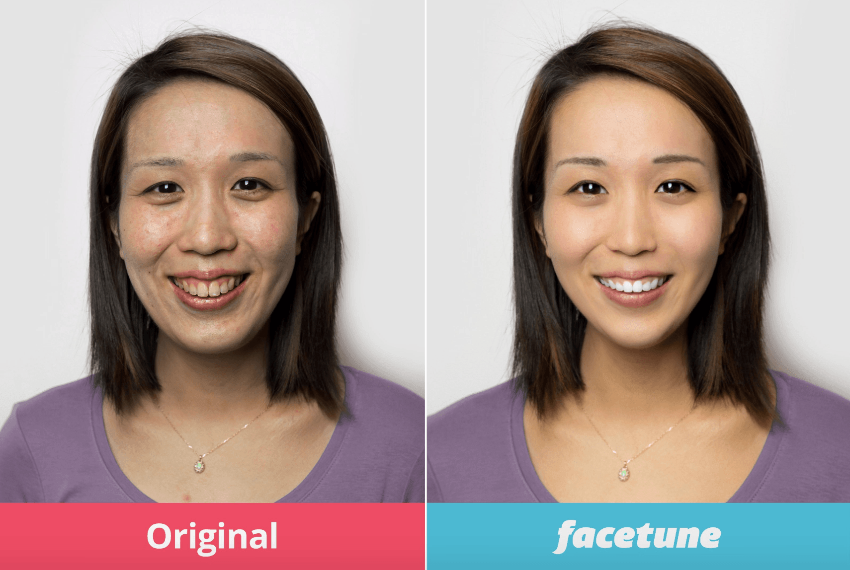 Die Gesichtsveränderung einer Frau vor und nach einem Facelifting-Eingriff, wunderschön präsentiert in einem Instagram-Feed mit den fünf besten Designideen.