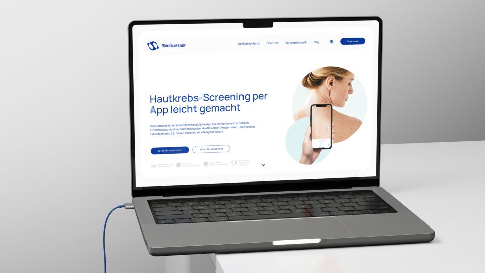 Auf einem Tisch steht ein SkinScreener-Laptop mit einer Frau darauf.